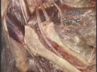 Human Anatomy - Maxillary & Mandibular nerve